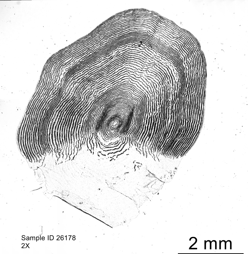 Magnified salmon scale showing dense concentric growth rings around a central focus, with a 2 mm scale bar.
